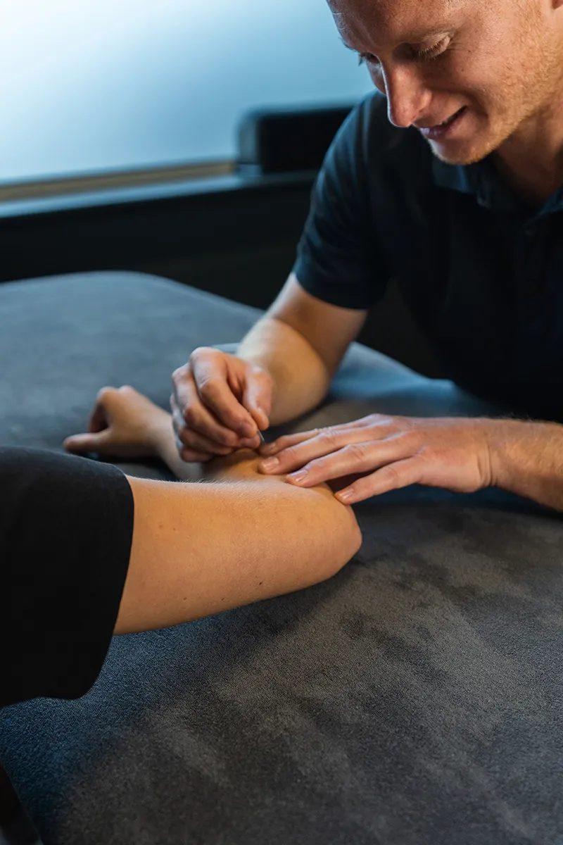 Positieve effecten van dry needling, ontdek ze hier!
